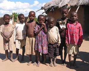 Jiggers-Disese-barefoot