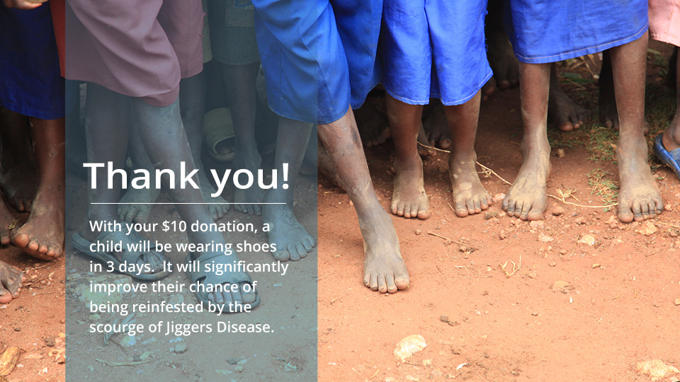 Saving-a-child-from-Jiggers-Disease Saving a child from Jiggers Disease